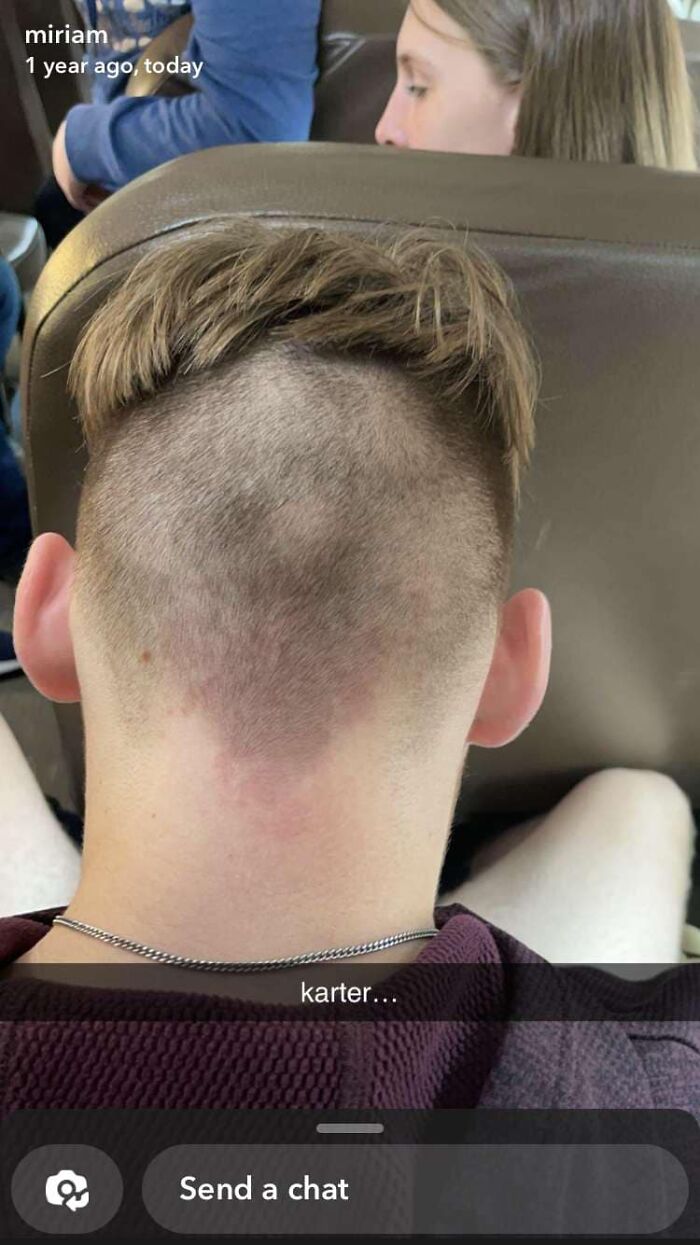 Back view of a person with a patchy haircut, an example of a hair fail.