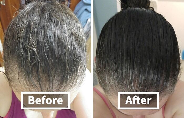 Before and after photos showing hair transformation using problem-solving products.