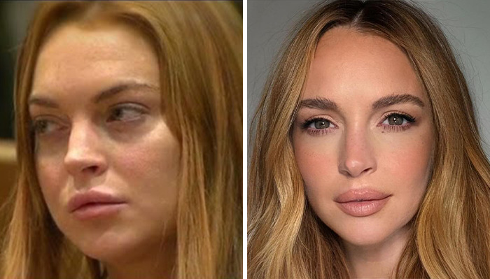 Lindsay Lohan in a before and after collage.