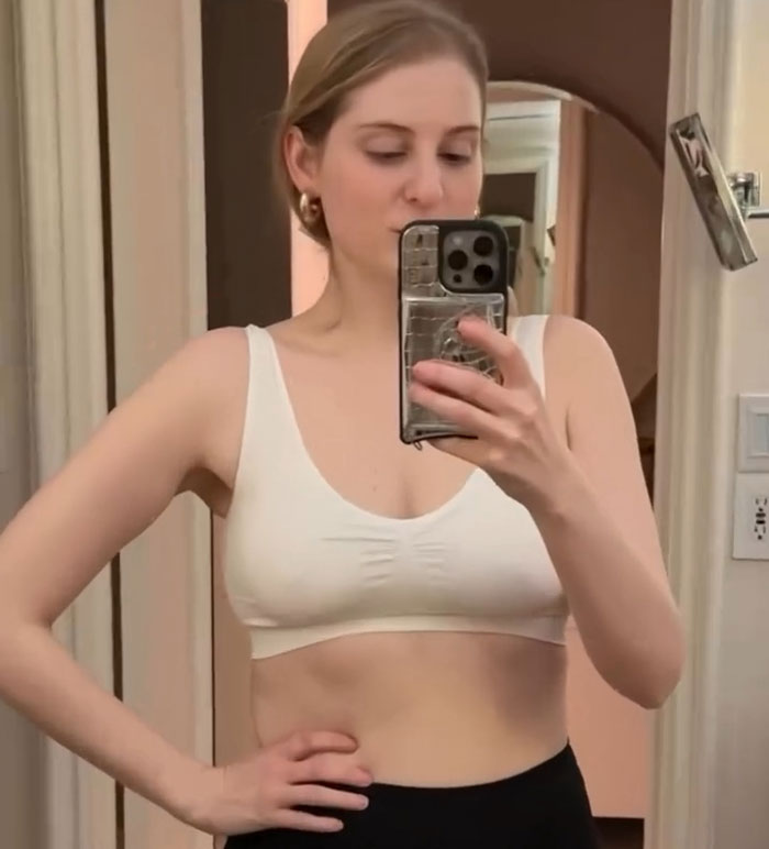 “Lyrics Have Aged Well”: Meghan Trainor Slammed For Breast Augmentation After Body-Positive Songs